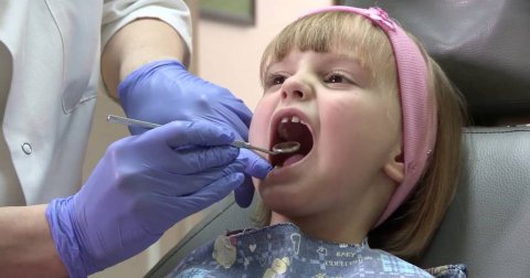 Alarmantni podaci – trećina dece ima karijes na mlečnim zubima
